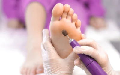 Pedicure podologiczny. Jak wygląda pielęgnacja stóp u podologa w Sosnowcu?